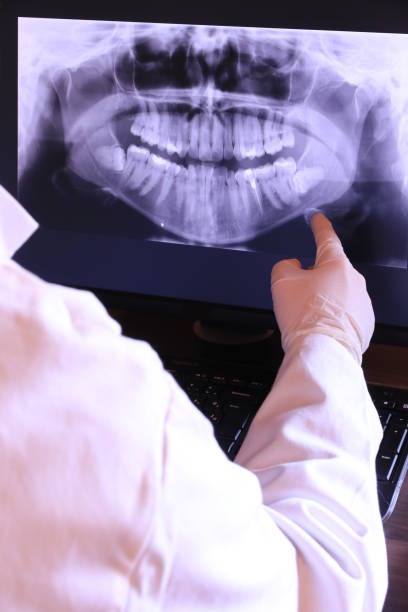 Best Emergency Wisdom Teeth Removal in Garden View, PA