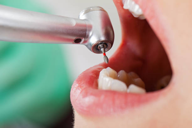 Best Emergency Treatment for Toothache in Garden View, PA